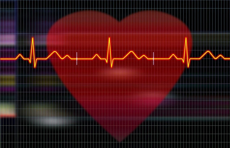 EKG image